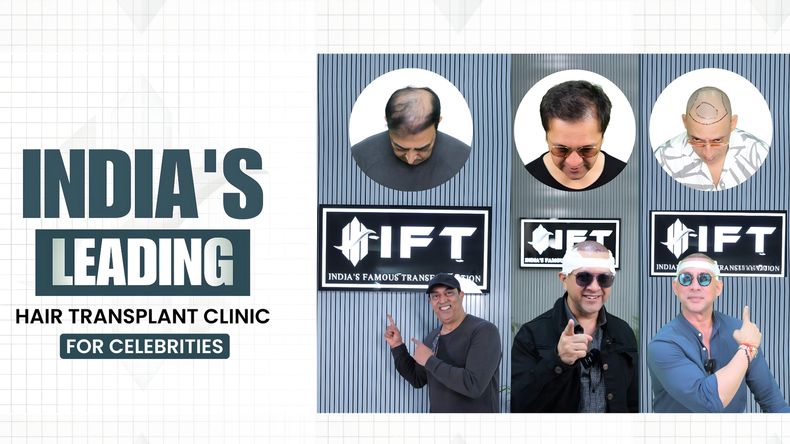 celebrity hair transplant