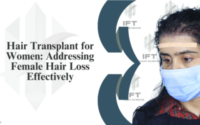 Hair Transplant for Women: Addressing Female Hair Loss Effectively