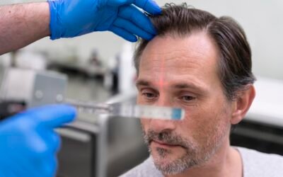 Seasonal Hair Loss: Why It Happens and How to Stop It 