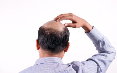 The Science Behind Hair Transplants: How Do They Work
