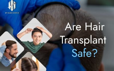 Are hair transplant safe?