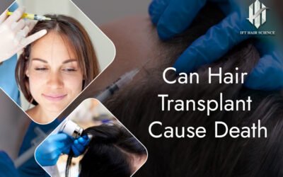 Hair transplant never cause death