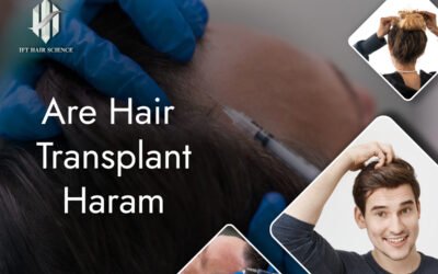 Are hair transplant haram