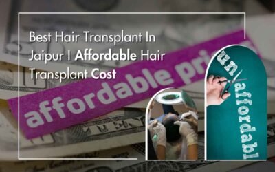 BEST HAIR TRANSPLANT IN JAIPUR | AFFORDABLE HAIR TRANSPLANT COST