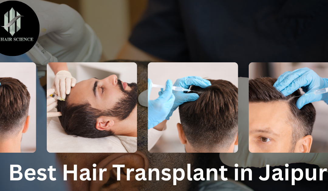 Discover the Best Hair Transplant in Jaipur at IFT Hair Science