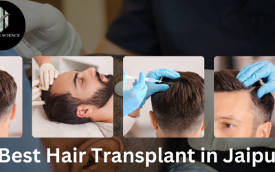 Discover the Best Hair Transplant in Jaipur at IFT Hair Science