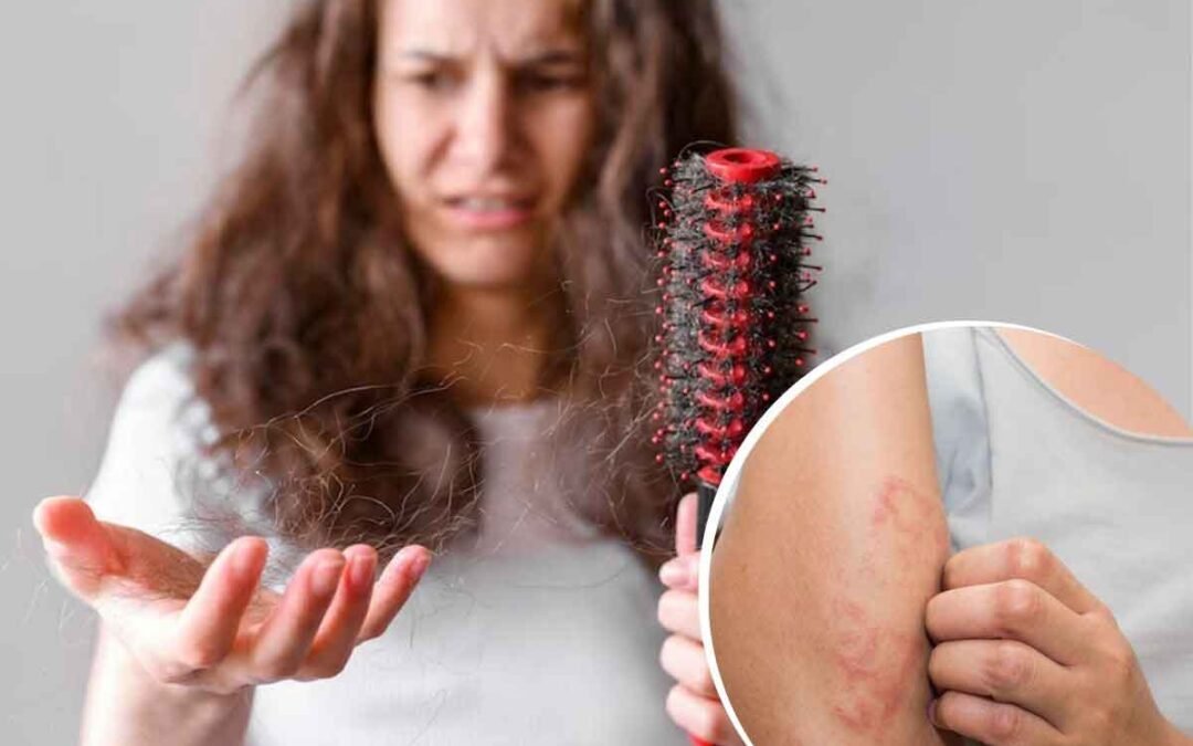 Discover Hair Loss Causes: Unveiling Diseases That Trigger Hair Fall