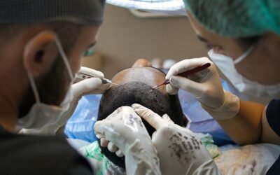 Top 5 Signs You Need a Hair Transplant Consultation