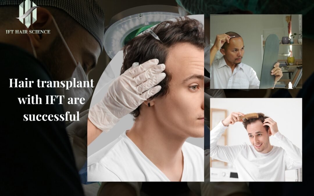 Hair transplant with IFT are successful