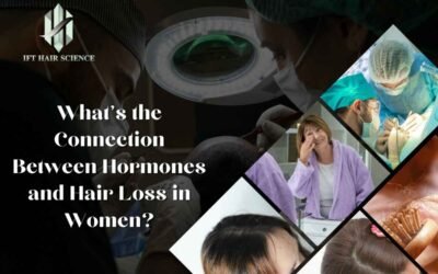 What’s the Connection Between Hormones and Hair Loss in Women
