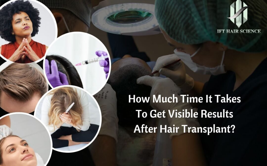 How much time it takes to get visible results after hair Transplants