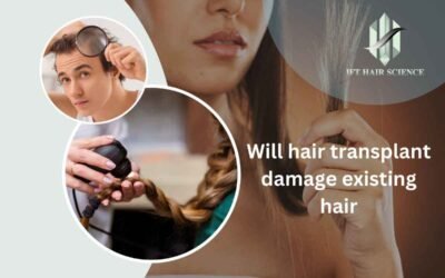 Will hair transplant damage existing hair
