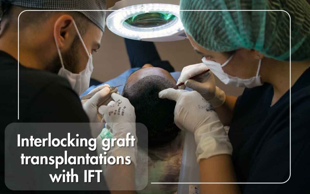 Unlocking the Secrets of Interlocking Graft Transplantation: Innovative Hair Loss Solutions at IFT Hair Science Clinic in Jaipur