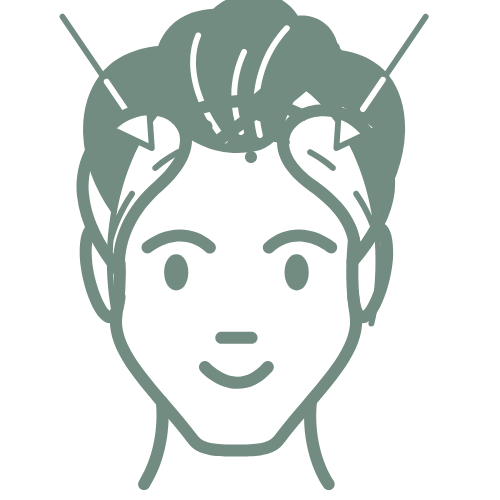 Temple Hair Transplant