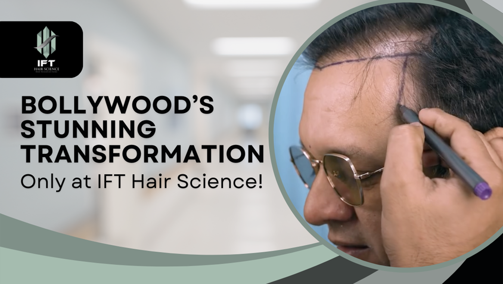 Imran Khan’s Hair Transformation: The Bollywood Star’s New Look at IFT Hair Science