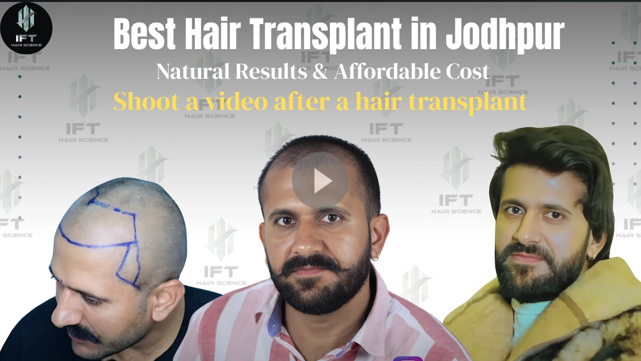 Best Hair Transplant in Jodhpur ✅ Natural Results Affordable Cost IFT Hair Science