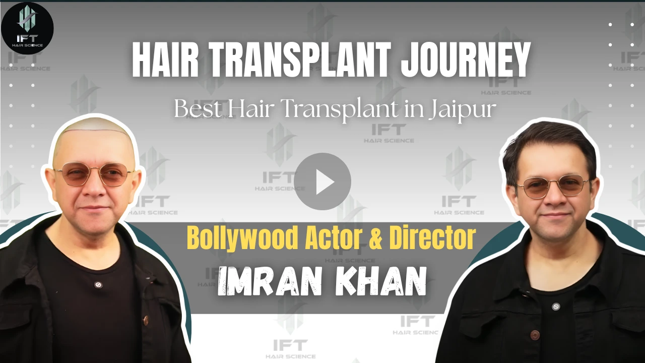 Bollywood Actor Director Imran Khan Hair Transplant Journey Best Hair Transplant in Jaipur