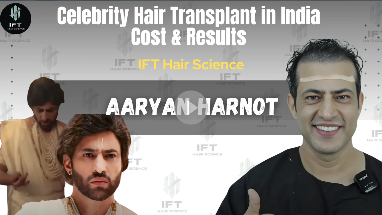 Celebrity Hair Transplant in India Cost Results IFT Hair Science