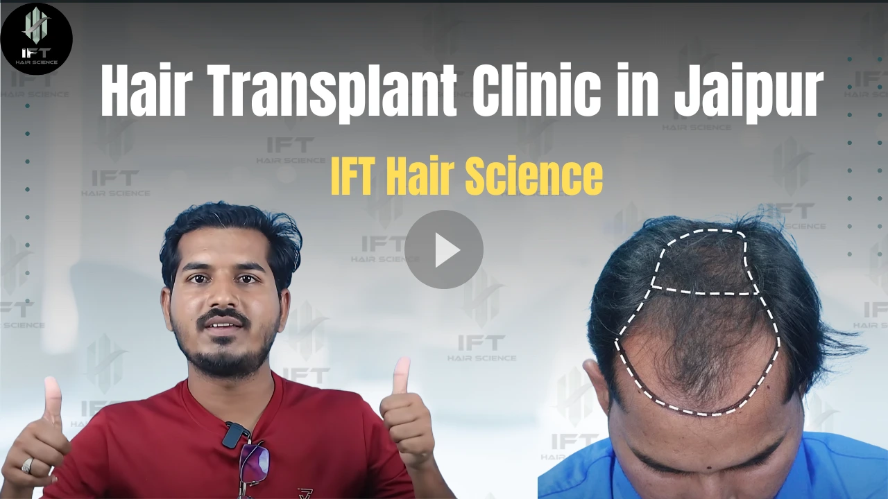 Hair Transplant Clinic in Jaipur