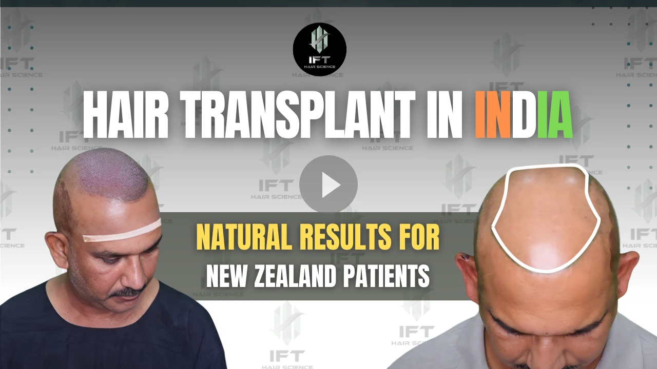 Hair Transplant in India Natural Results for New Zealand Patients - IFT Hair Science